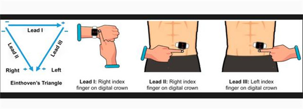 研究表明苹果Apple Watch具有潜在检测心脏病发作的能力
